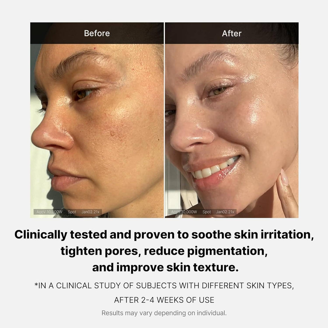 Before-and-after of skin using MEDICUBE Triple Collagen Cream (available in 50ml, 80ml); shows improved smoothness and glow.