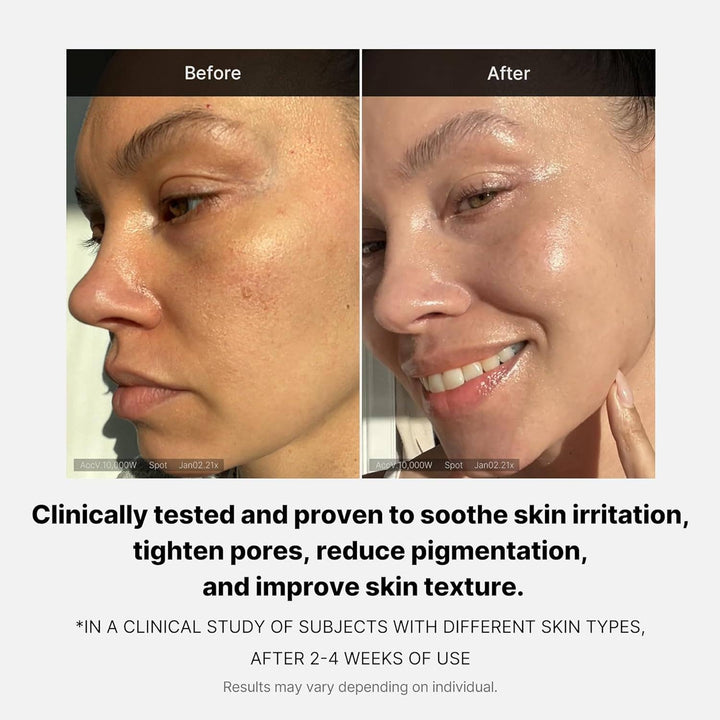 Before-and-after of skin using MEDICUBE Triple Collagen Cream (available in 50ml, 80ml); shows improved smoothness and glow.