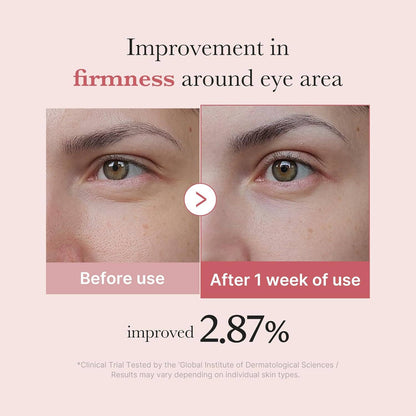 Close-ups show reduced fine lines and smoother skin after 1 week using MEDICUBE PDRN Pink Peptide Eye Cream (30ml, 50ml).