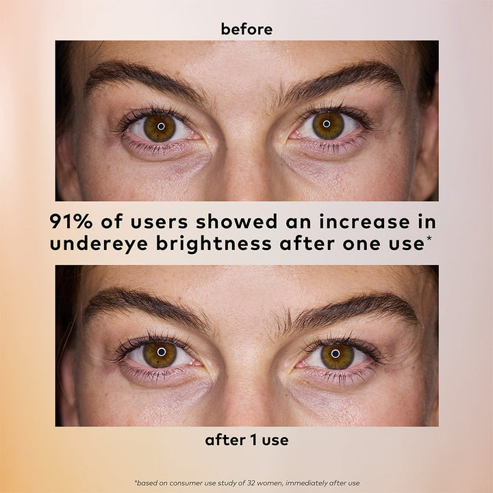 Brighten Up Patch hydrogel under eye patches, available in standard and large sizes. 91% saw brighter, less dark circles after one use.