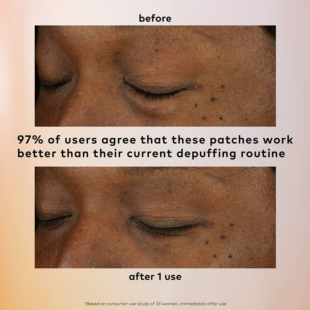 Before/after De-Puff Patch: reduced under-eye puffiness. Available in small, medium, large. 97% user preference shown.